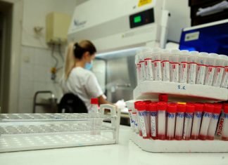 Trebinje ponovo u vrhu – Na virus korona pozitivne još 154 osobe u Srpskoj